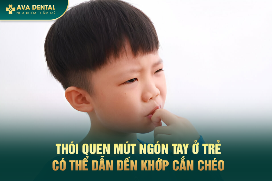 Khớp Cắn Chéo Là Gì? Chi Phí Niềng Răng Khớp Cắn Chéo Mới Nhất 2024 21 308
