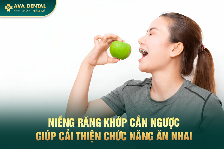 Khớp Cắn Hở Là Gì? Chi Phí Niềng Răng Khớp Cắn Hở Giá Tốt Tại TP.HCM 14 4 5
