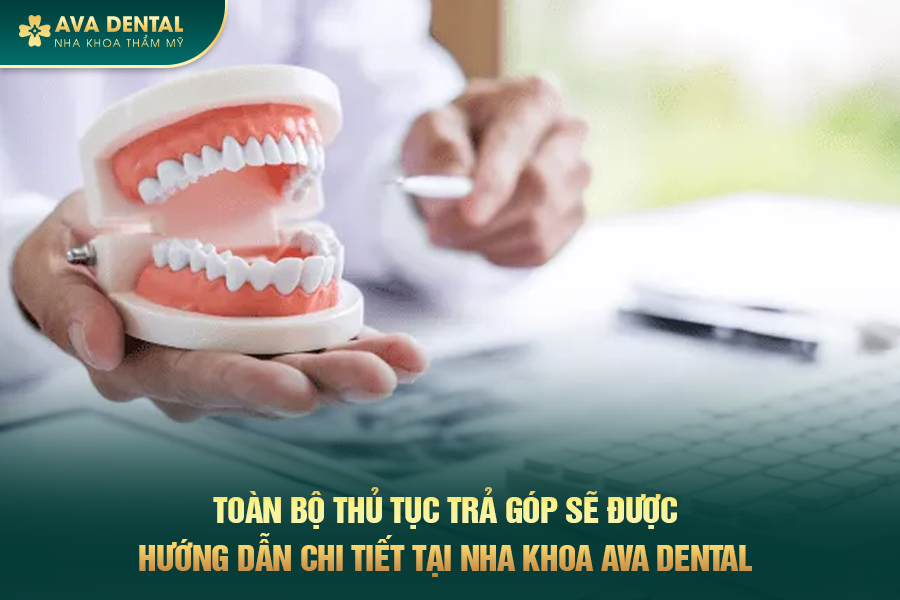 Avora Dental - Dịch Vụ Dán Sứ Veneer Trả Góp Lãi Suất 0% Tại TP.HCM 20 boc rang su tra gop 4