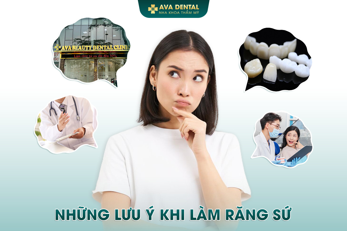 Chi Phí Bọc Răng Sứ Thẩm Mỹ Bao Nhiêu? Bảng Giá Mới Nhất 2024 33 nhung luu y khi lam rang su