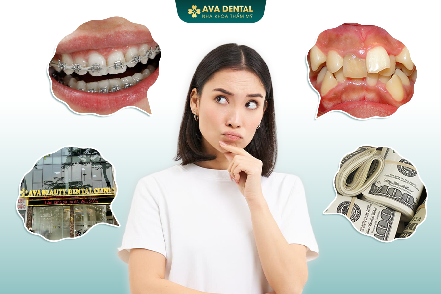 Niềng Răng Là Gì? Chi Phí Niềng Răng Mới Nhất 2024 18 nhung yeu to quyet dinh chi phi