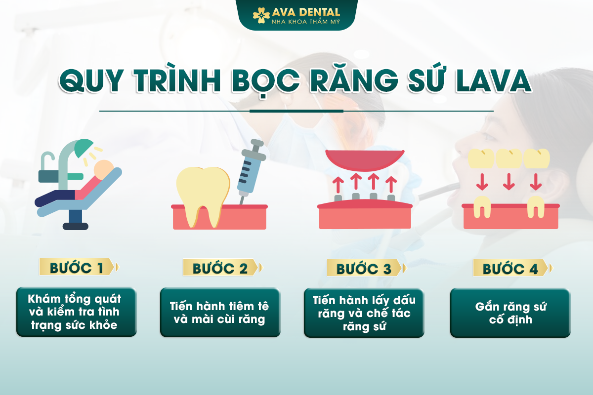 Răng Sứ Lava Esthetic Là Gì? Có Tốt Không? Chi Phí Bao Nhiêu 2024 25 quy trinh boc rang su lava