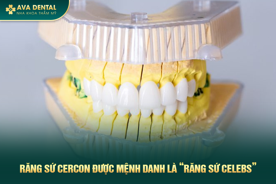Răng Sứ Cercon Là Gì? Phân Loại Và Bảng Giá Mới Nhất 2024 17 rang su cercon 4