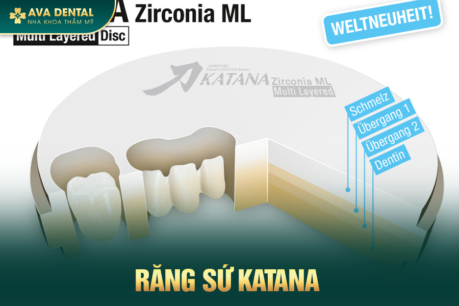 Răng Sứ Katana Là Gì? Có Tốt Không? Bảng Giá Mới Nhất 2024 12 rang su han quoc 1 1