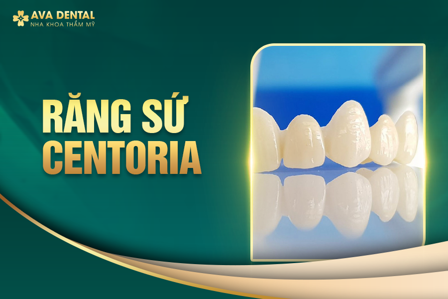 Răng Sứ Hàn Quốc Là Gì? Có Tốt Không? Bảng Giá Mới Nhất 2024 14 rang su han quoc 1