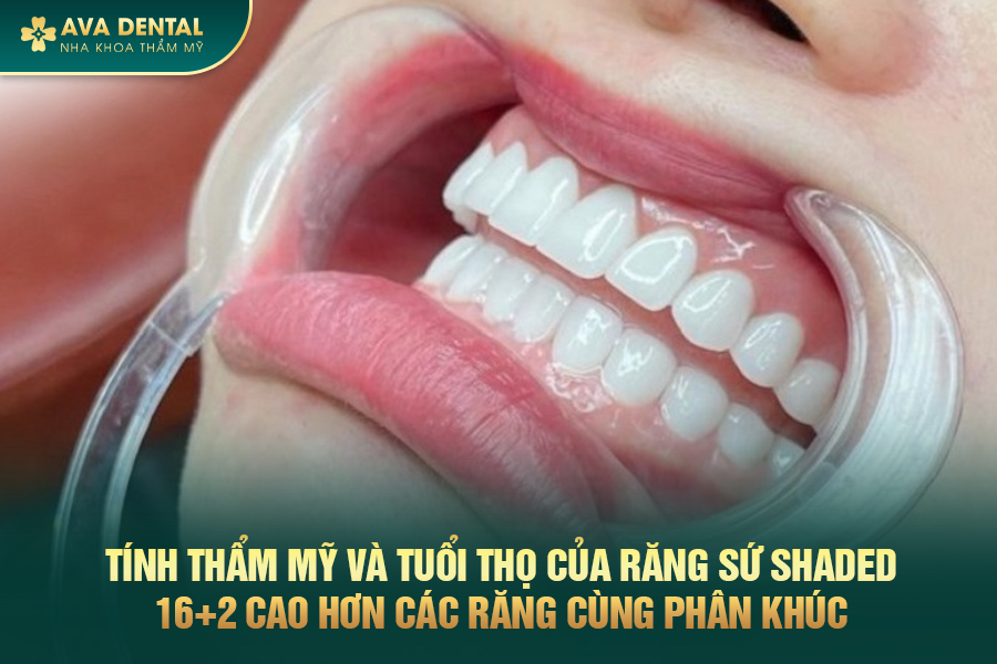 Răng Sứ Nacera Là Gì? Có Tốt Không? Chi Phí Bao Nhiêu 2024 21 rang su nacera 3