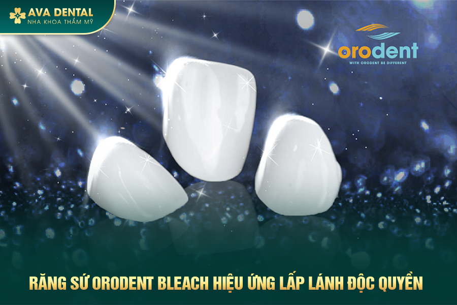 Răng Sứ Orodent Bleach Là Gì? Có Tốt Không? Chi Phí Bao Nhiêu 2024 19 rang su orodent bleach 1