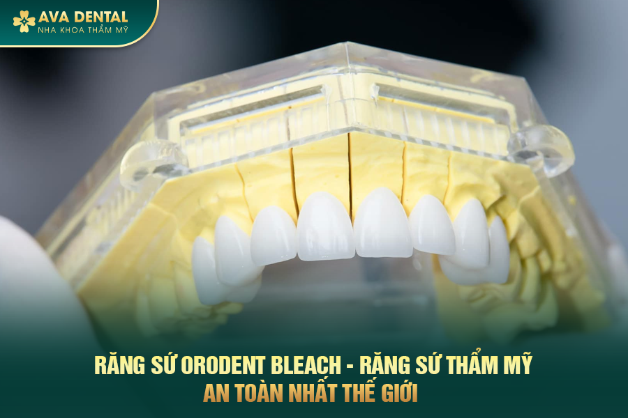 Răng Sứ Orodent Bleach Là Gì? Có Tốt Không? Chi Phí Bao Nhiêu 2024 20 rang su orodent bleach 2