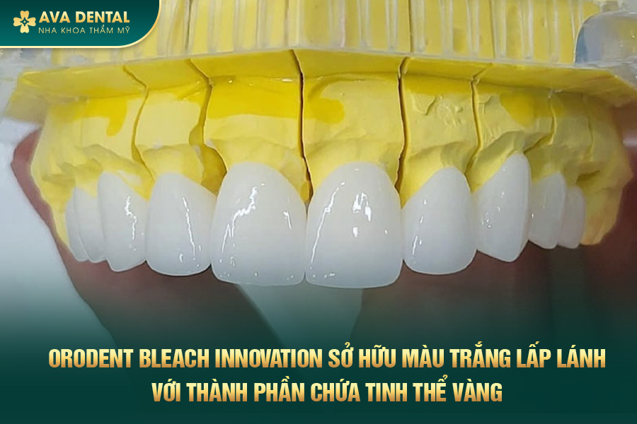 Răng Sứ Orodent Bleach Innovation Là Gì? Có Tốt Không? Chi Phí Bao Nhiêu 2024 19 rang su orodent bleach innovation 2
