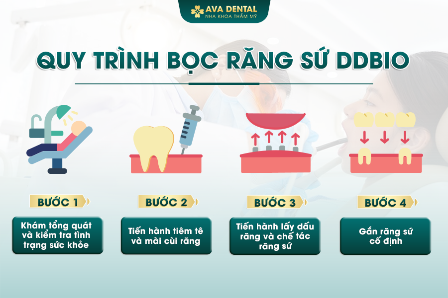 Răng Sứ DDBio Là Gì? Có Tốt Không? Chi Phí Bao Nhiêu 2024? 21 1 16