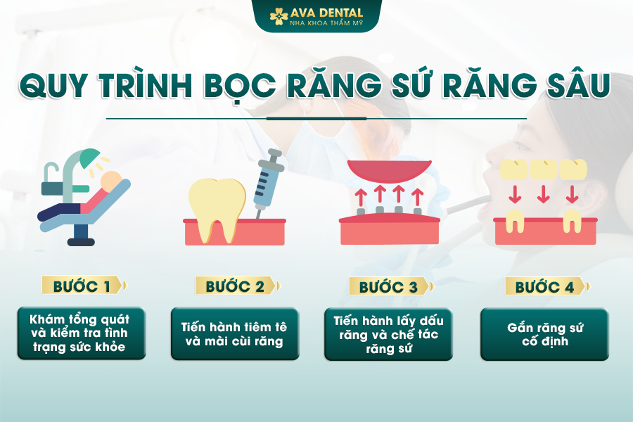 Bọc Răng Sứ Cho Răng Sâu Là Gì? Chi Phí Bao Nhiêu 2024? 27 1 9