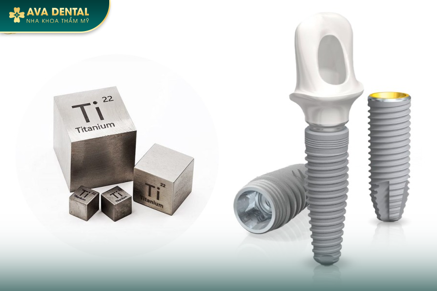 Top 3 Dòng Trụ Implant Mỹ Tốt Được Các Chuyên Gia Khuyên Dùng 20 101 6