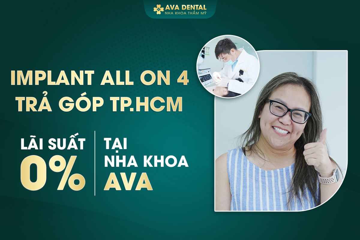 Trồng Răng Implant All On 4 Cho Người Mất Răng Toàn Hàm? Chi Phí Bao Nhiêu 2024? 24 2 14