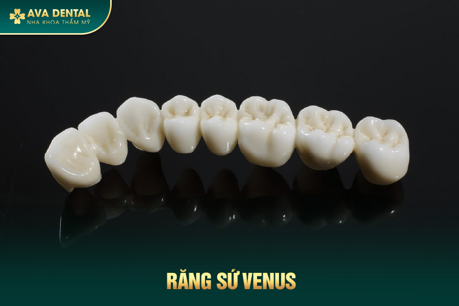 Răng Sứ Venus Là Gì? Có Tốt Không? Chi Phí Bao Nhiêu 2024 17 4 6