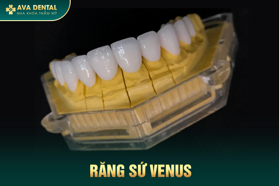 Răng Sứ Đức Là Gì? Có Tốt Không? Bảng Giá Mới Nhất 2024 26 venus