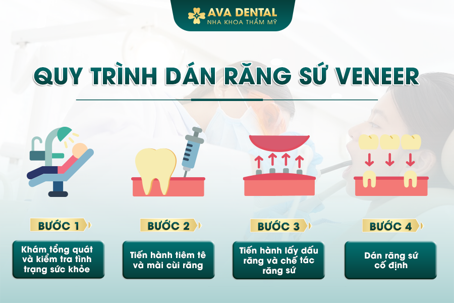 Dán Sứ Veneer Răng Cửa Có Tốt Không? Giá Bao Nhiêu 2024? 26 1 4