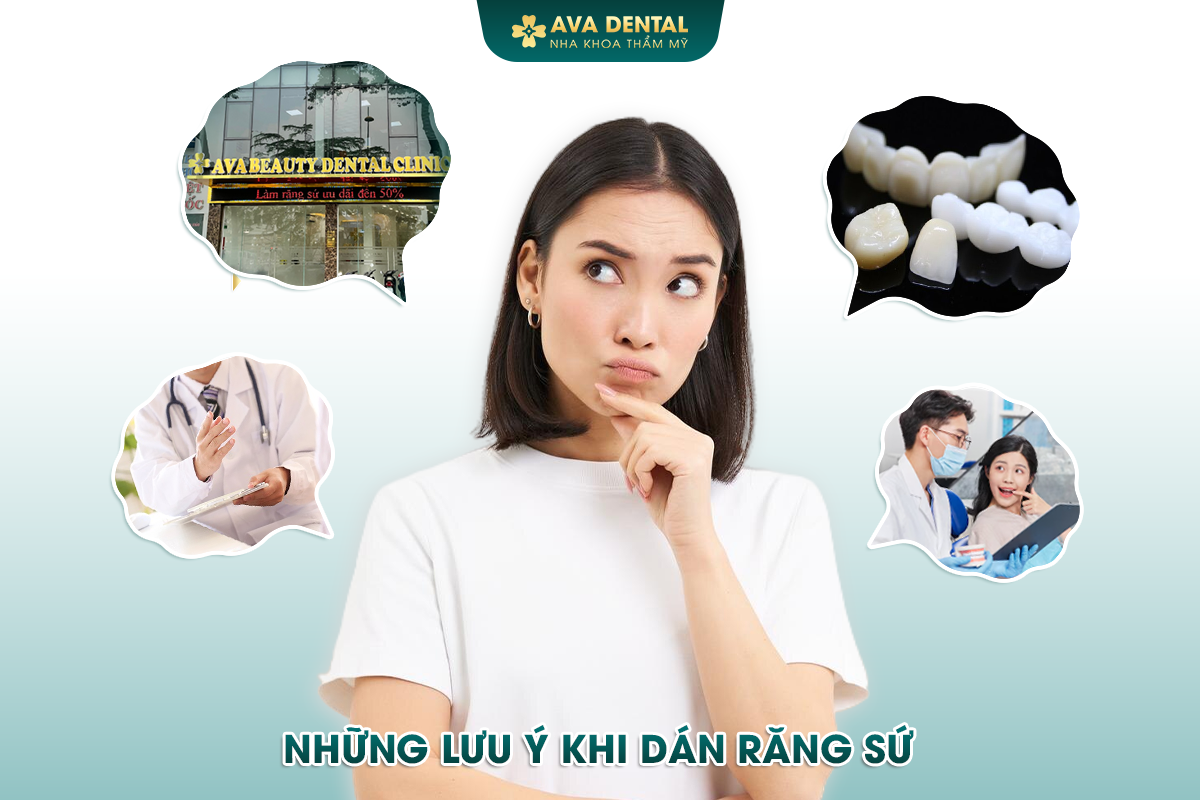 Avora Dental - Dịch Vụ Dán Sứ Veneer Trả Góp Lãi Suất 0% Tại TP.HCM 23 2 1