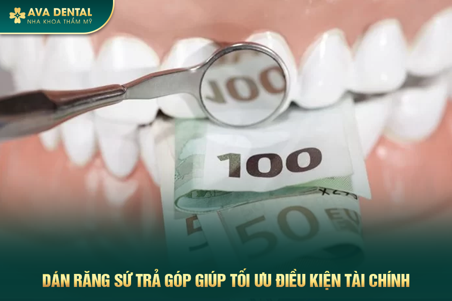 Avora Dental - Dịch Vụ Dán Sứ Veneer Trả Góp Lãi Suất 0% Tại TP.HCM 17 2 4