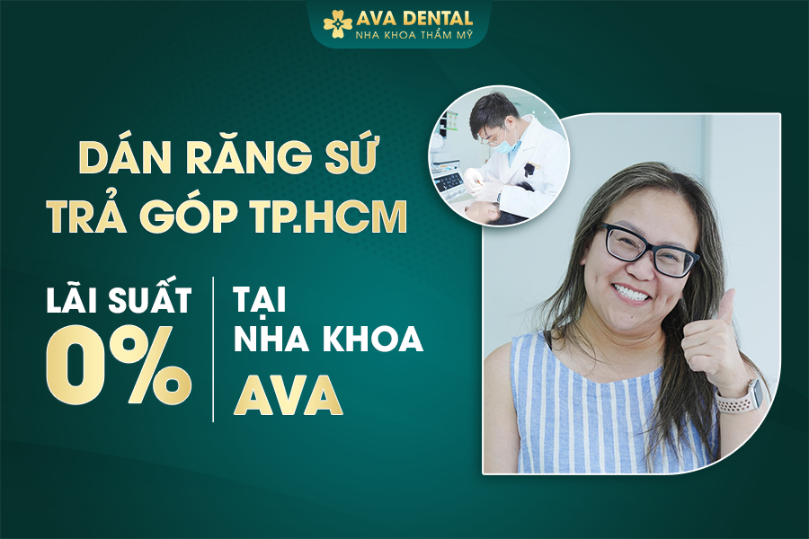 Dán Sứ Veneer Răng Cửa Có Tốt Không? Giá Bao Nhiêu 2024? 25 3 1