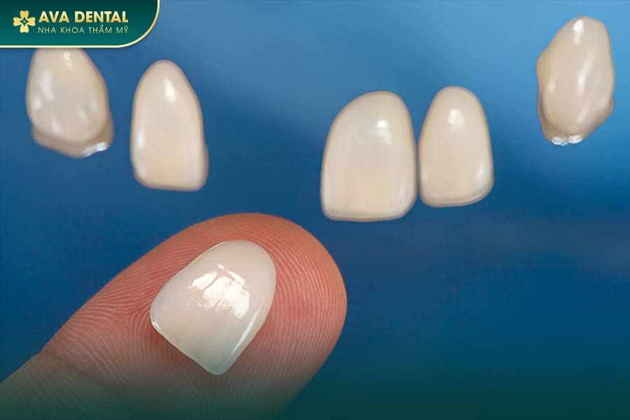 Răng Sứ Zirconia Là Gì? Có Mấy Loại? Bảng Giá Mới Nhất 2024 23 8
