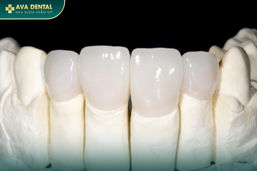 Răng Sứ Zirconia Là Gì? Có Mấy Loại? Bảng Giá Mới Nhất 2024 20 1