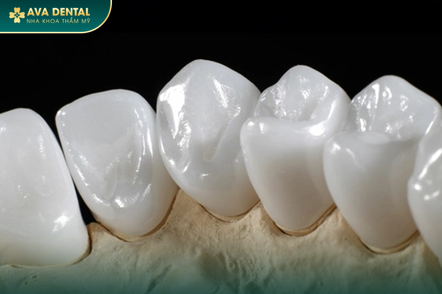 Răng Sứ Zirconia Là Gì? Có Mấy Loại? Bảng Giá Mới Nhất 2024 22 2