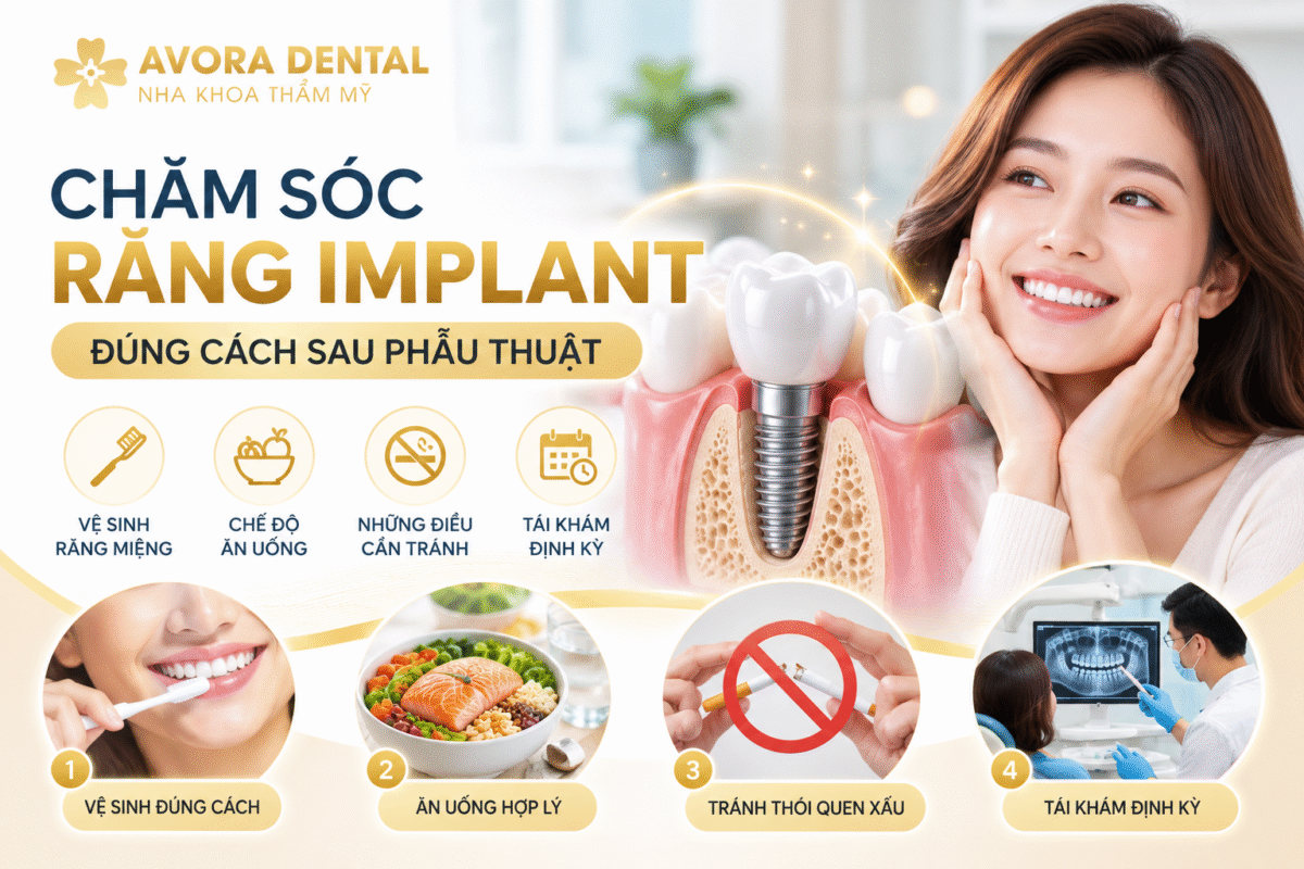 Chăm sóc răng Implant